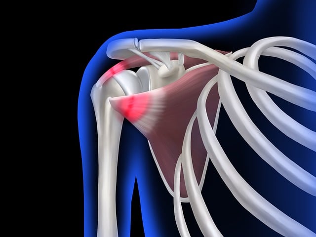 xray view of should pain and it's spiritual meaning